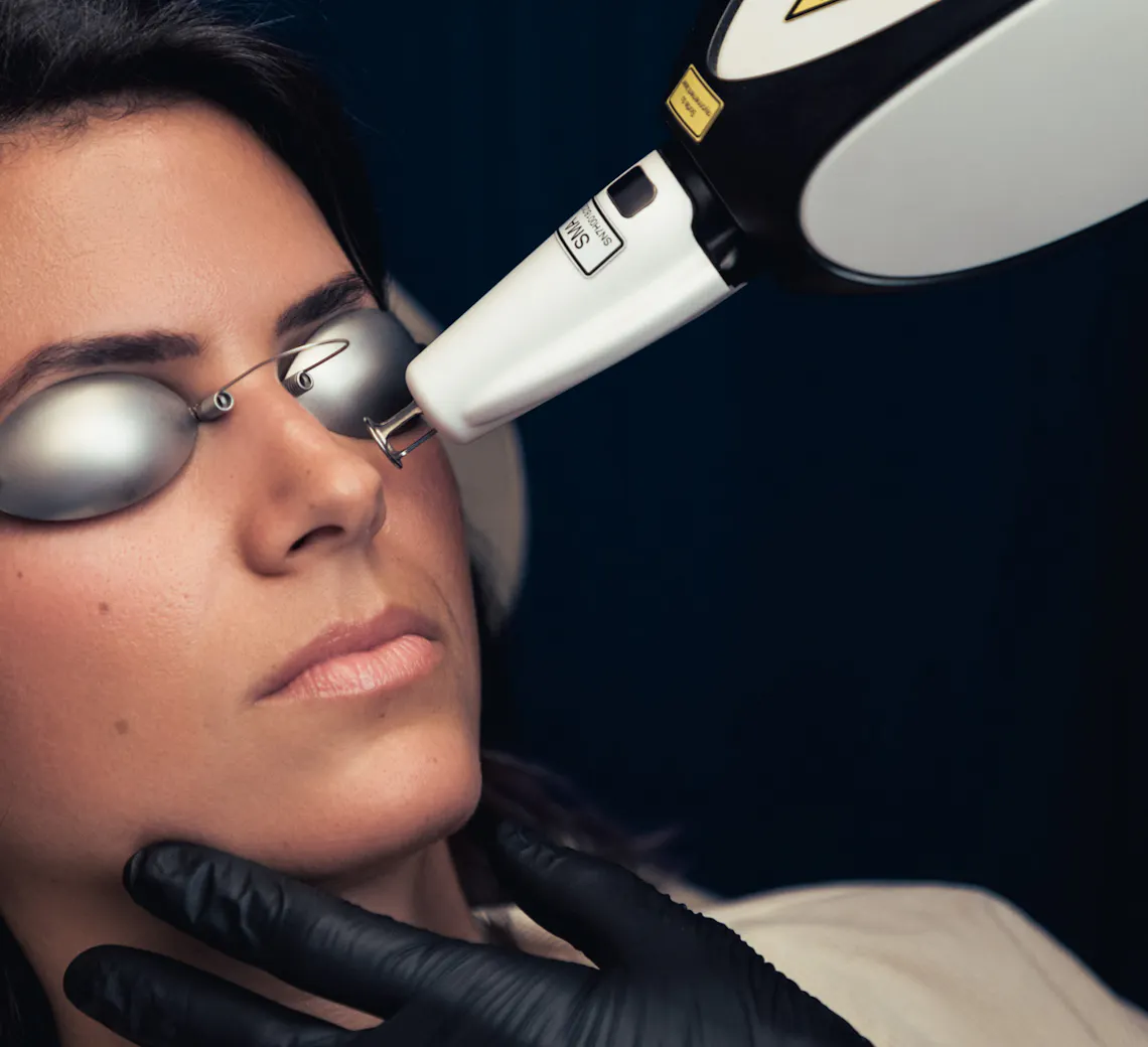 Laser vasculaire : éliminer les rougeurs de la peau pour un teint plus homogène