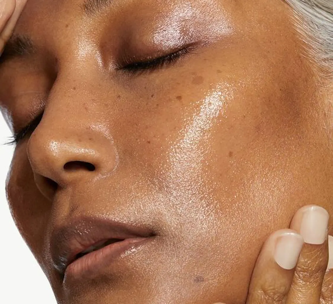 laser médecine esthétique