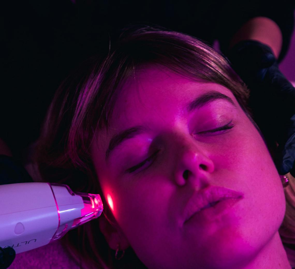 LaseMD peeling laser