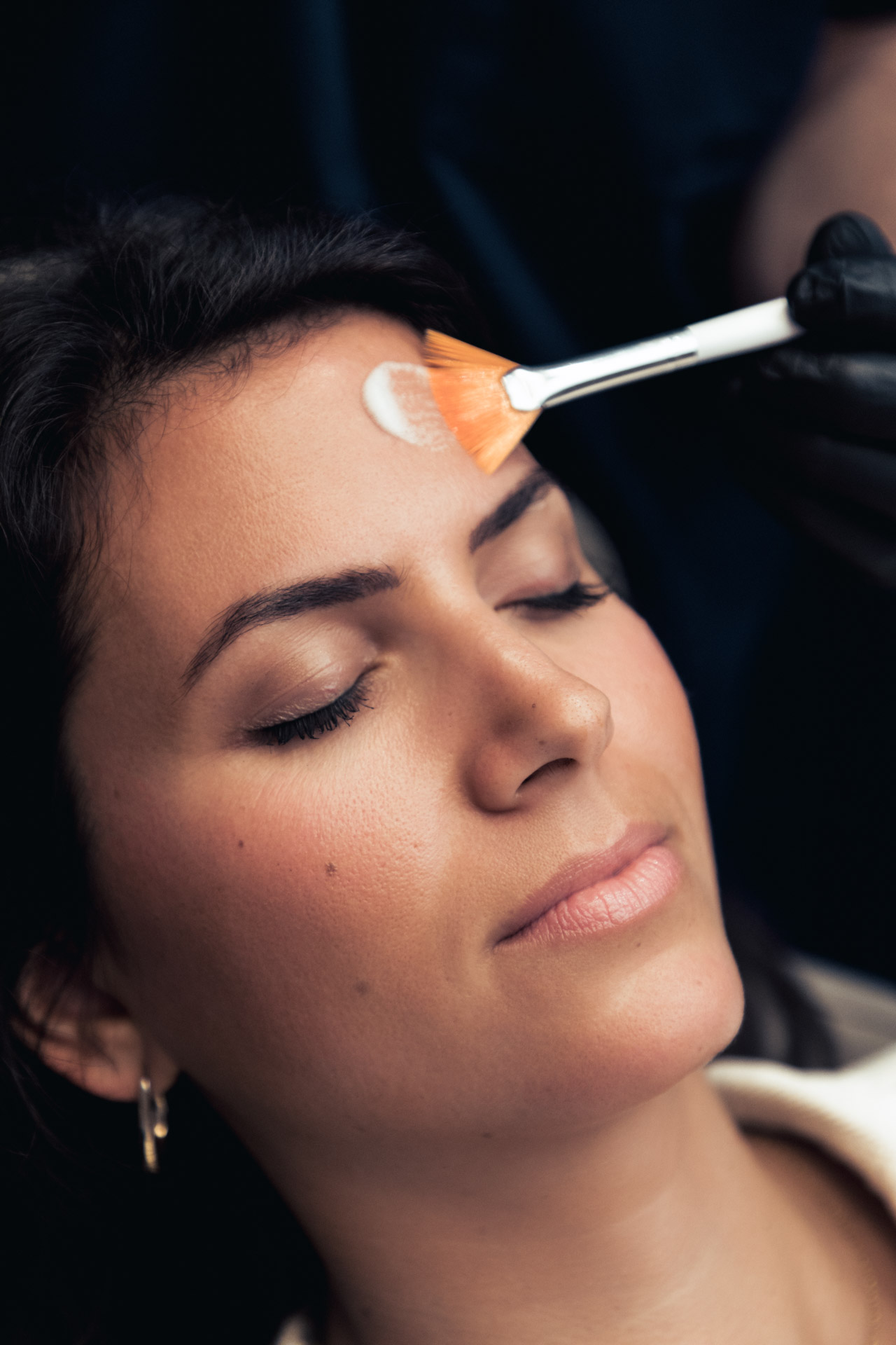 Amélioration de l'acné, cicatrice, qualité de la peau visage grâce aux peelings chez Maison Yoko à Lyon