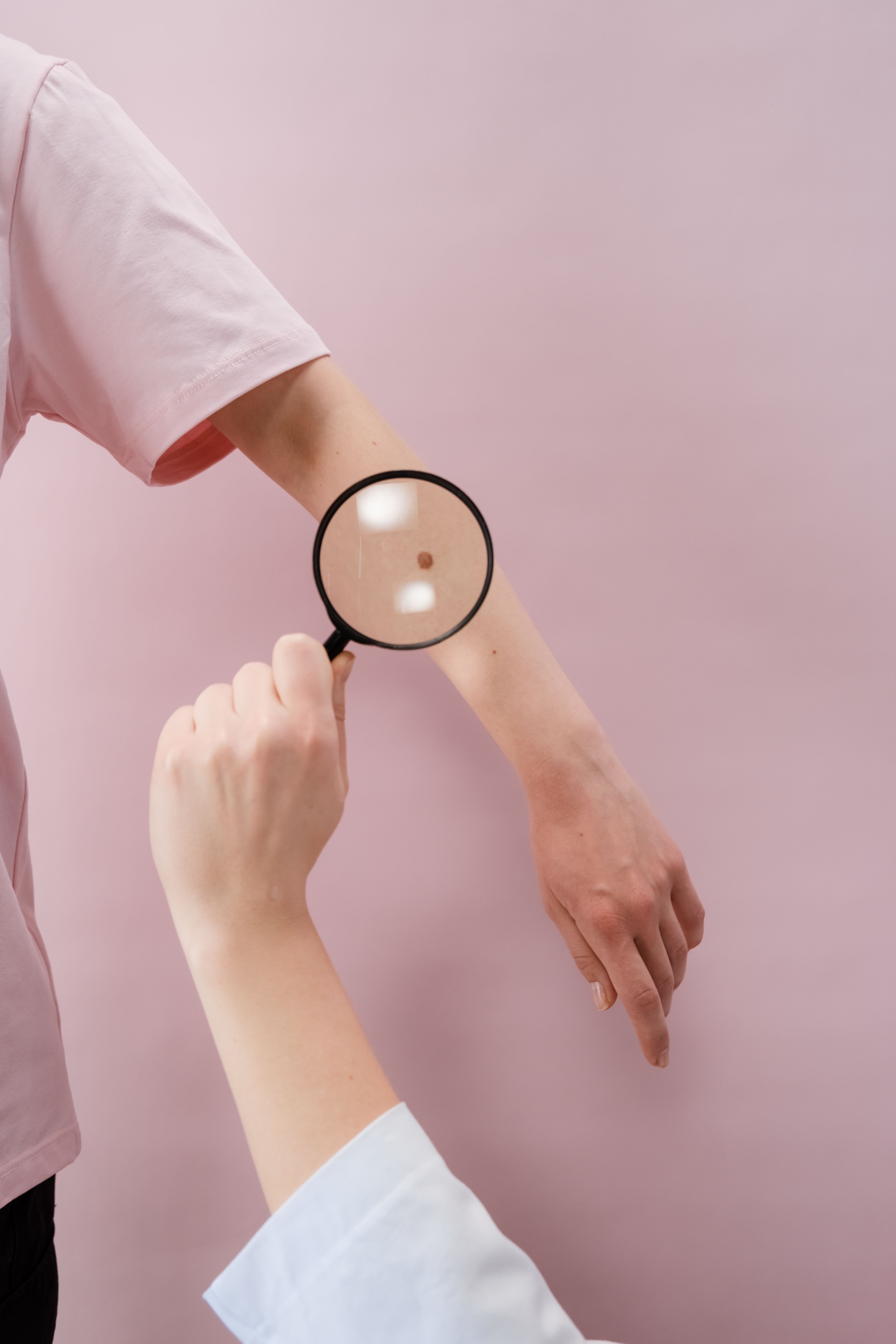 epilation laser : consultation préalable pour analyser la peau