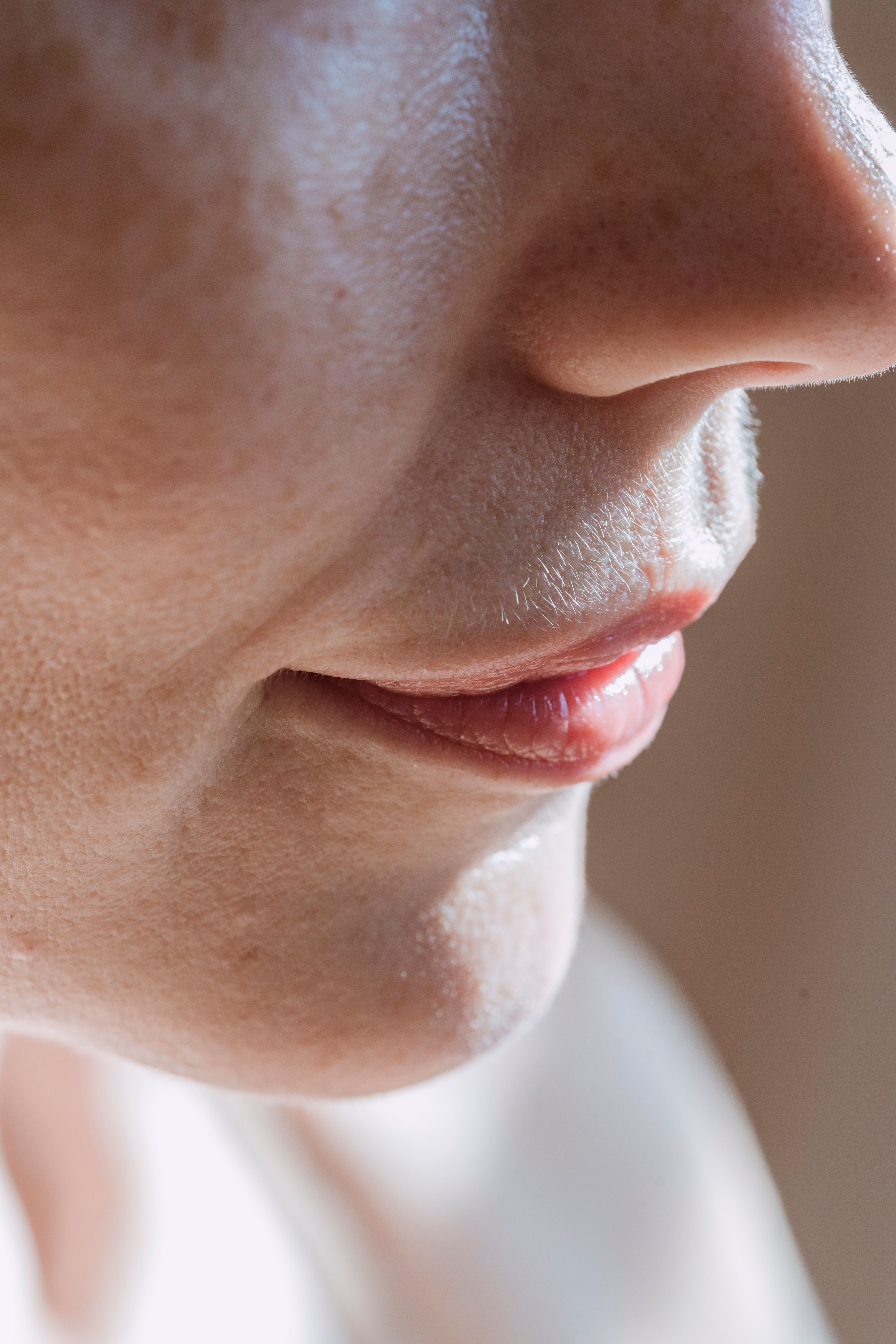 Radiofréquence microneedling chez Maison Yokō à Lyon : séance réalisée par un expert