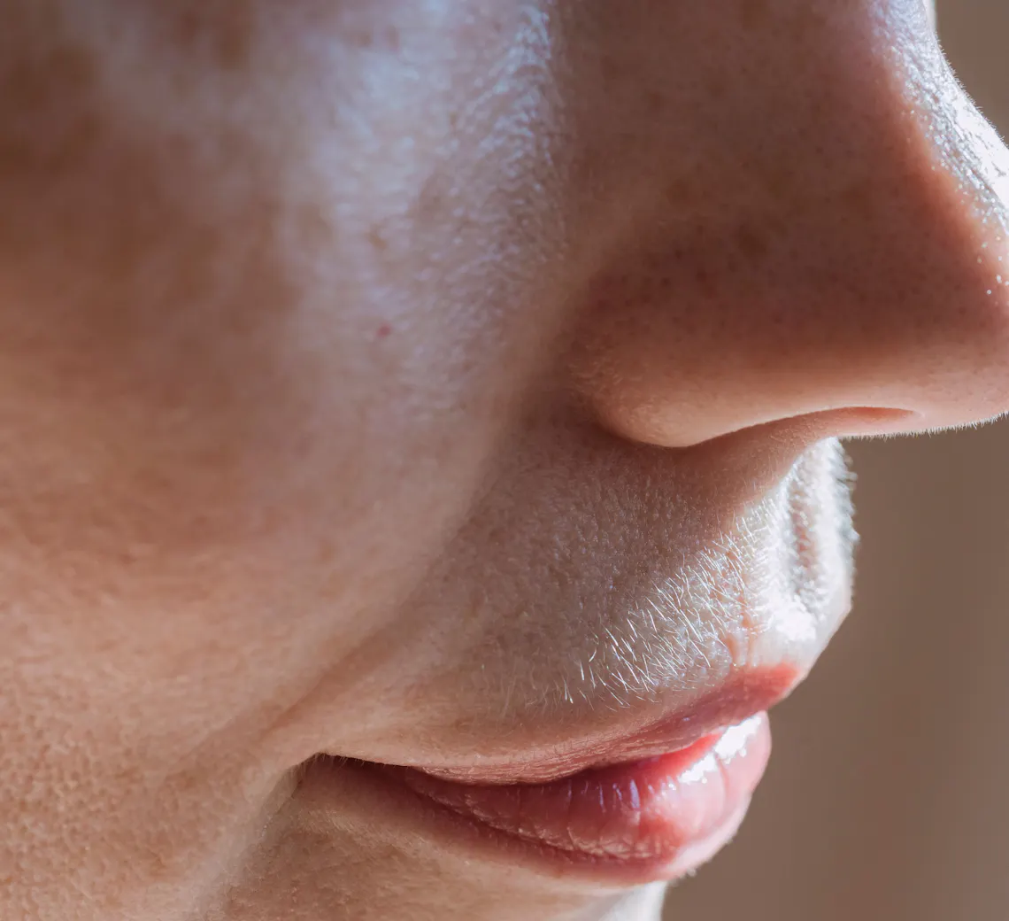 Radiofréquence microneedling chez Maison Yokō à Lyon : séance réalisée par un expert