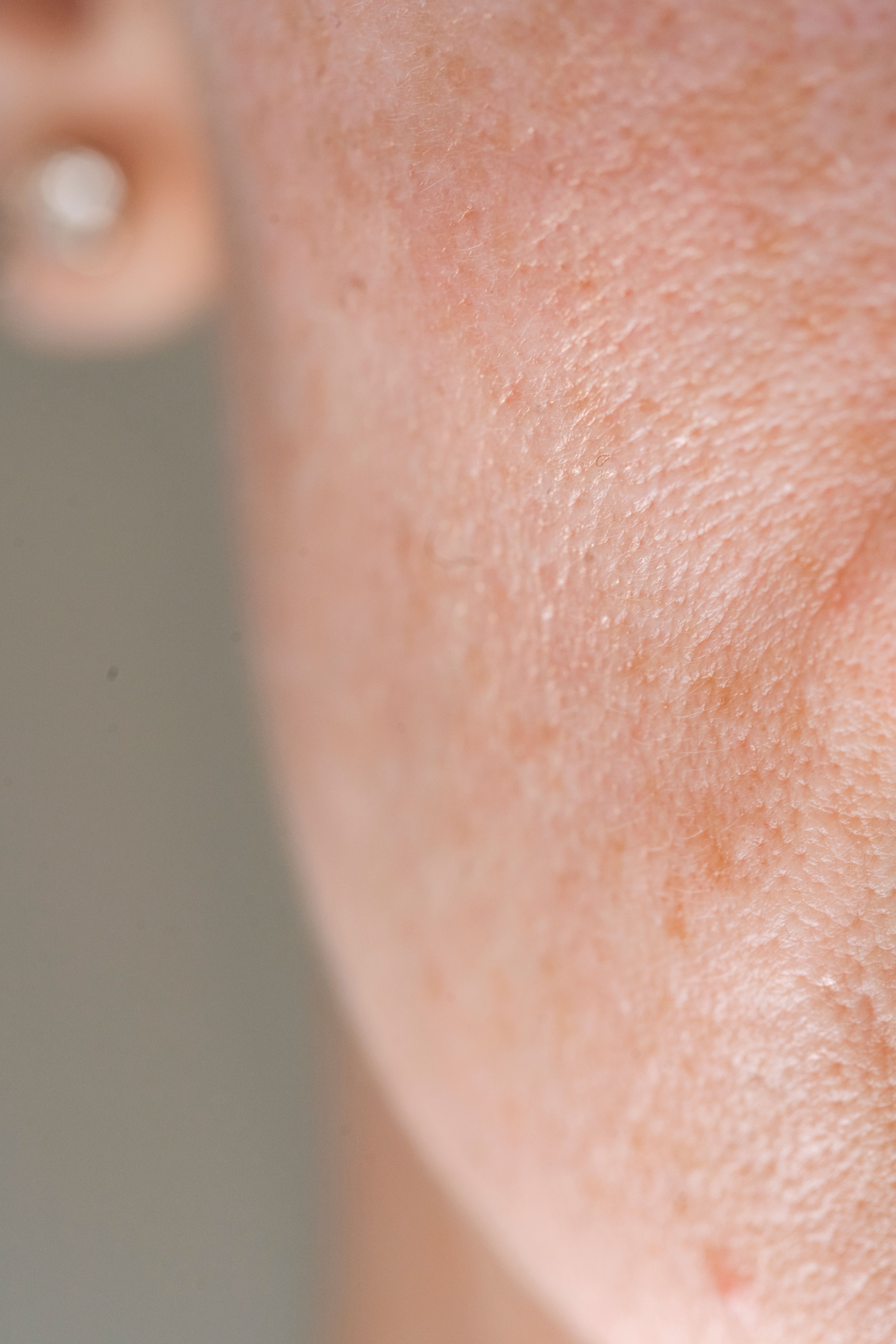 Grain de peau visage
