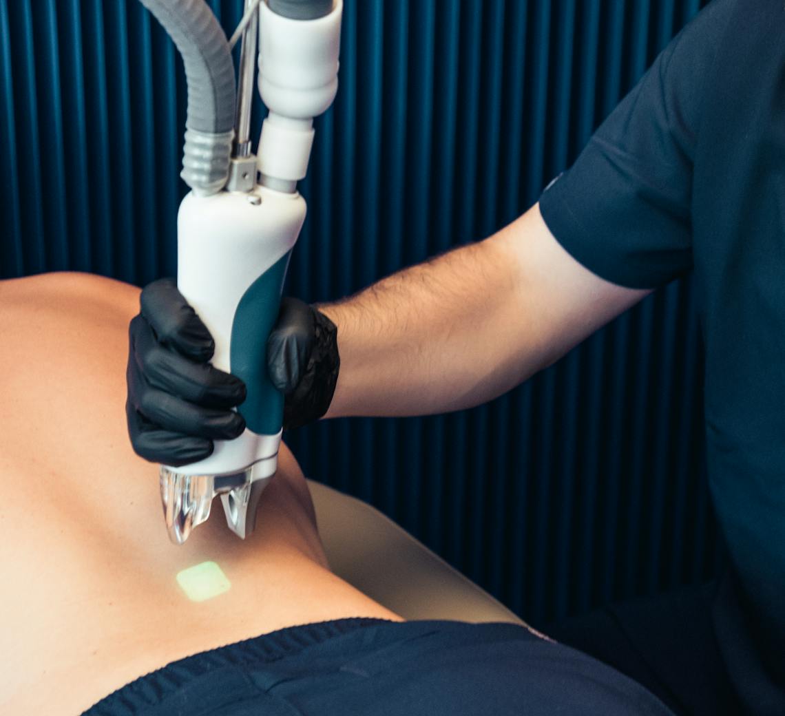 Epilation laser dos homme lyon