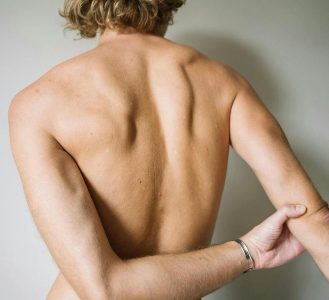 épilation laser homme