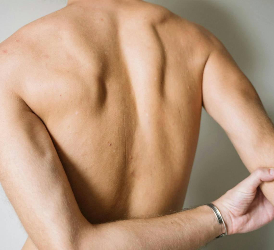 après séance epilation laser homme lyon