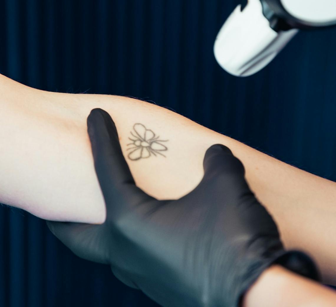 où retirer un tatouage à lyon maison yoko