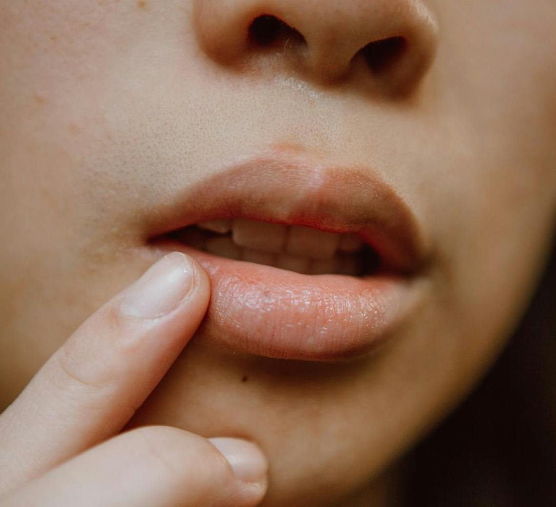bouche après injections