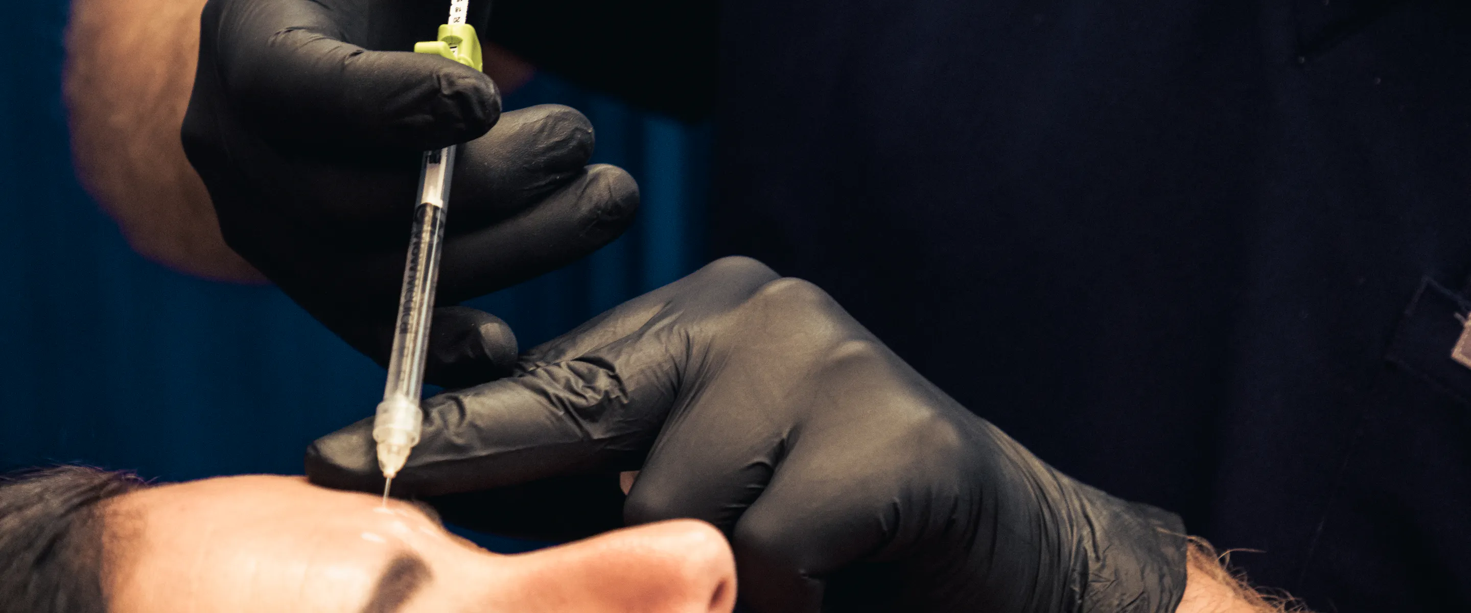 effets secondaires des injections de botox : c'est quoi la grippe du botox ?