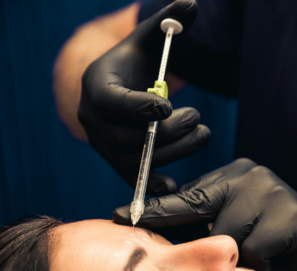 ride du lion et ride du lion