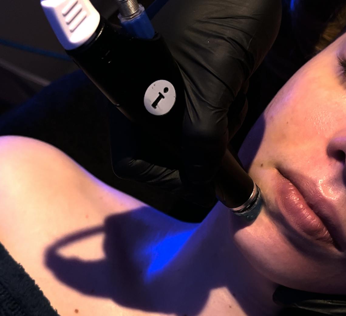 Hydrafacial Maison Yokō focus sur la technique sur le visage d'une patiente.