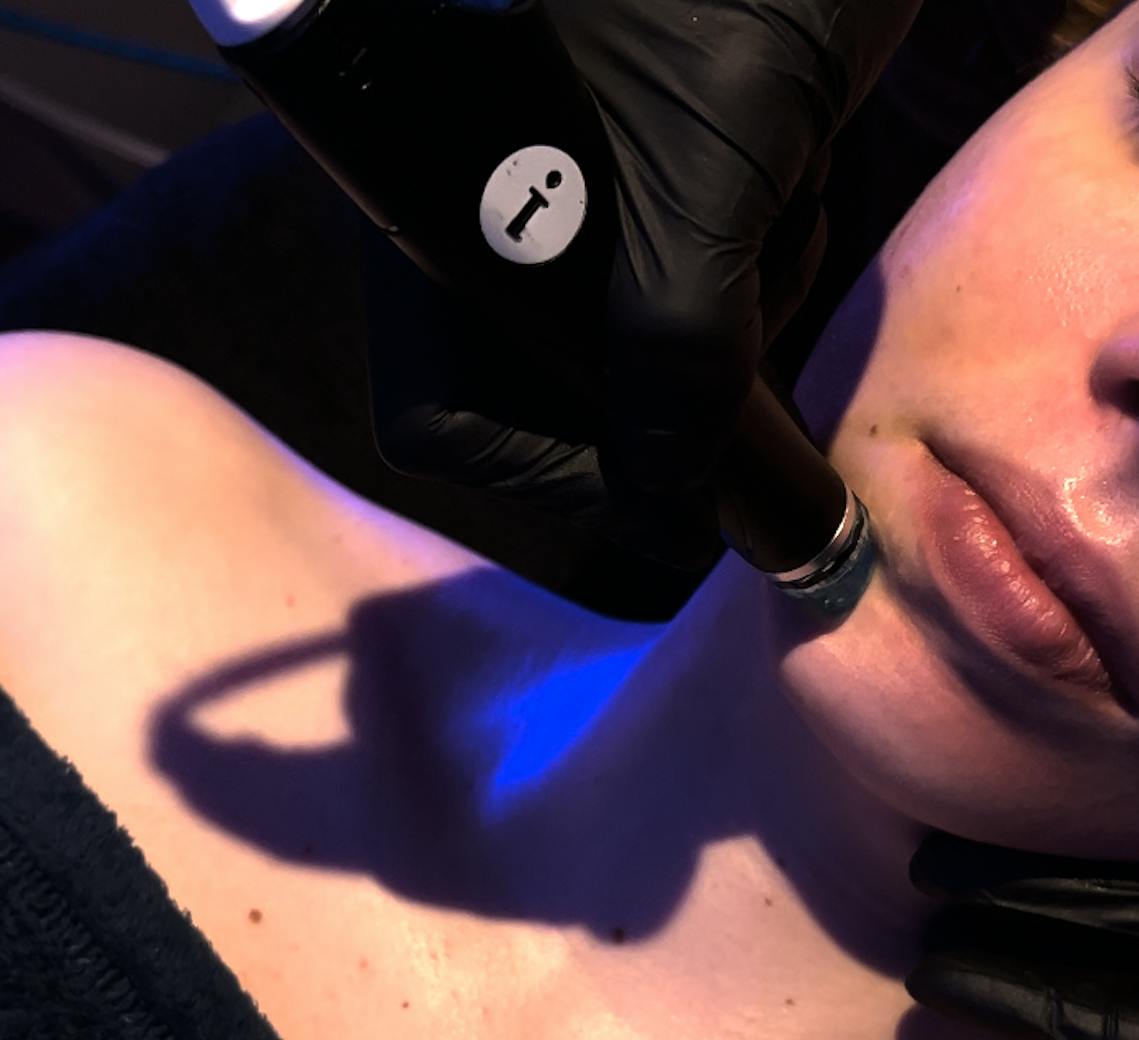 Hydrafacial Maison Yokō focus sur la technique