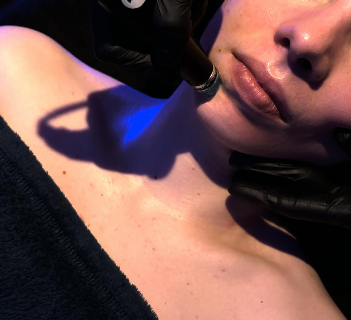 Hydrafacial Maison Yokō focus sur la technique