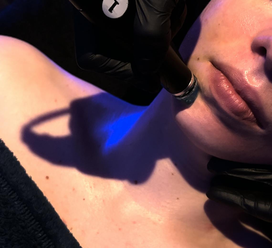 Hydrafacial Maison Yokō focus sur la technique