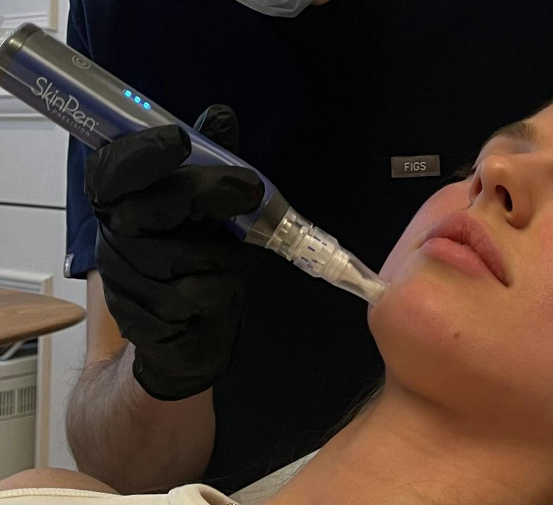 Patiente en consultation avec un médecin expert dans le cadre d'une séance de microneedling chez Maison Yokō à Lyon.