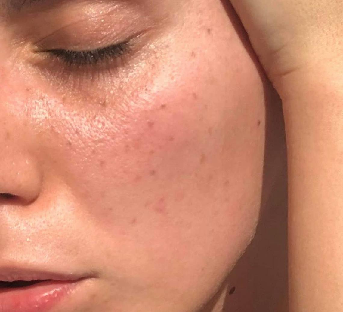 Jeune femme, focus sur son visage et sa peau au naturel.