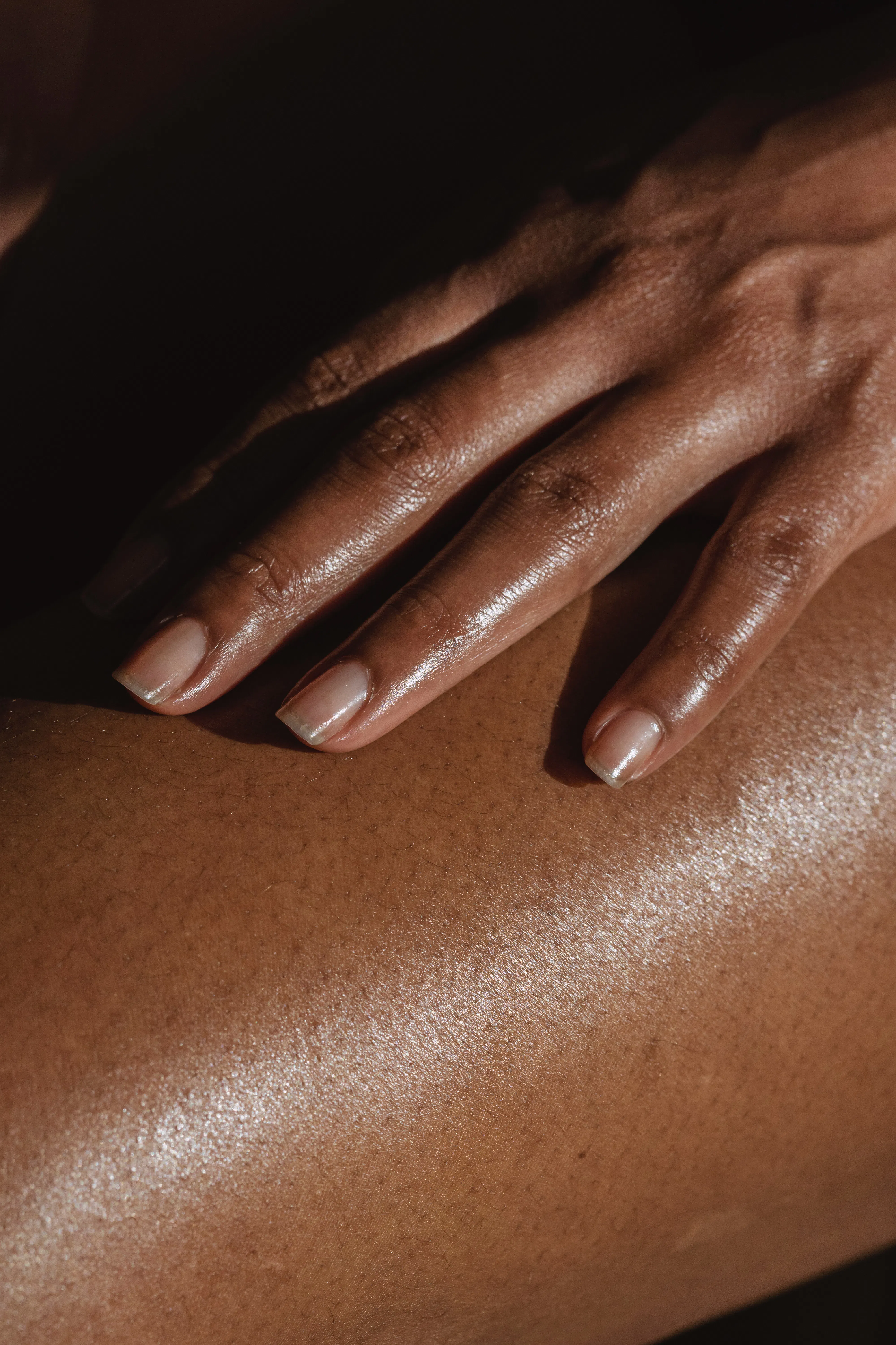 Peau mate ou noire : précautions avant un laser, un peeling ou une radiofréquence microneedling