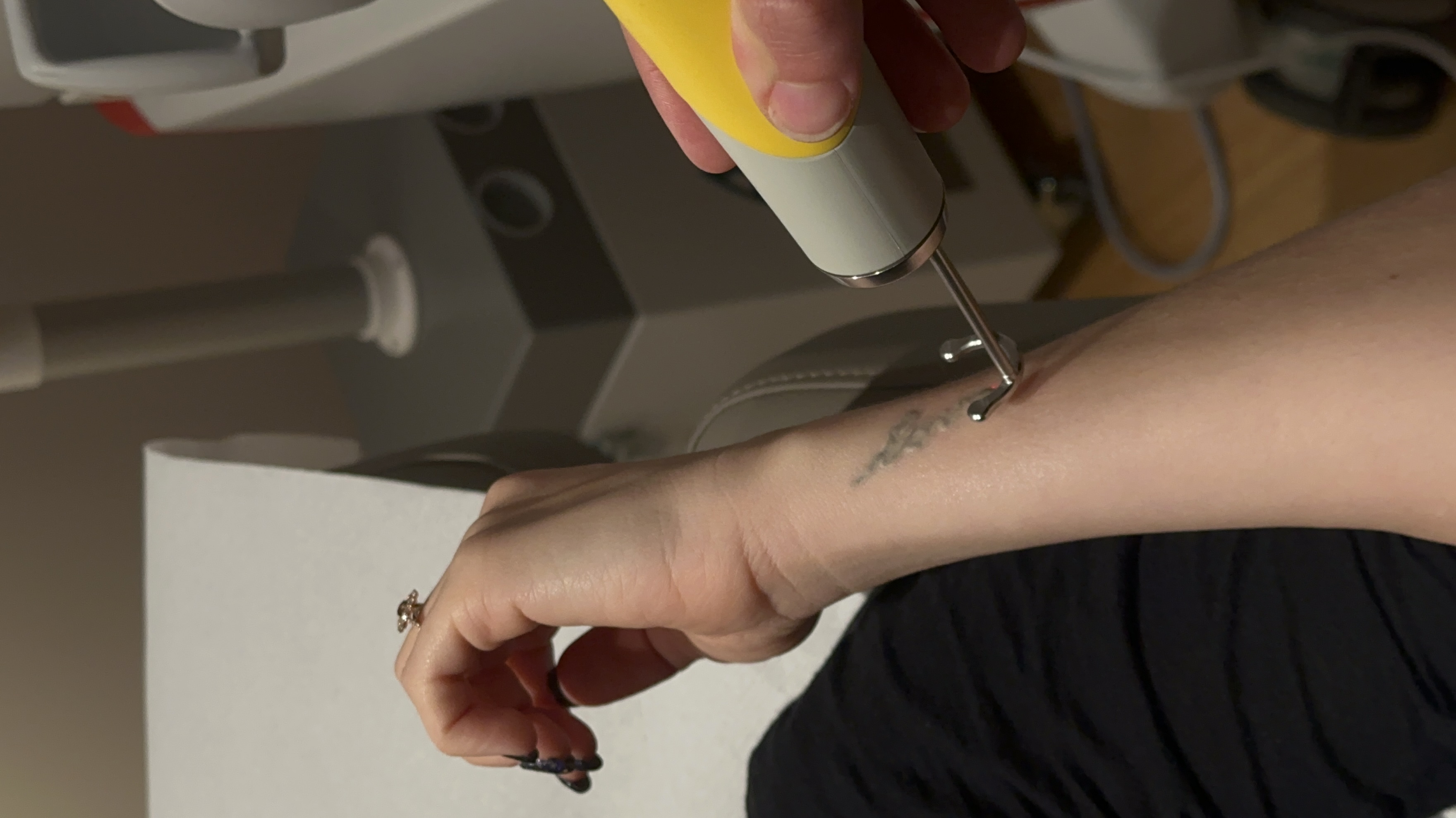 Détatouage laser : patiente en séance de détatouage laser chez Maison Yokō Lyon.