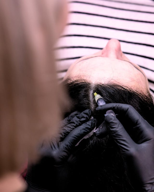 Mésothérapie capillaire chez Maison Yokō Lyon.