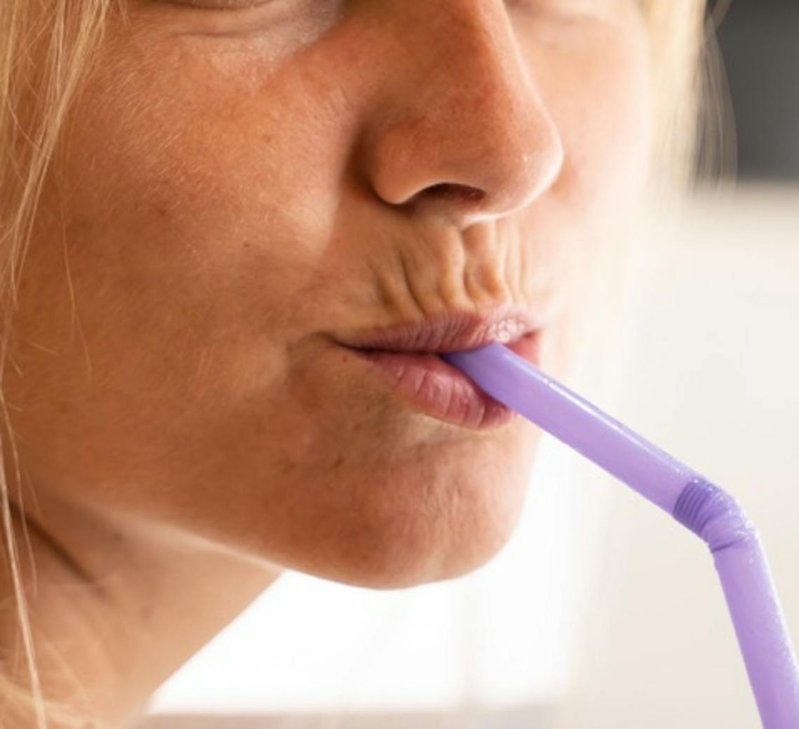 causes des rides autour de la bouche