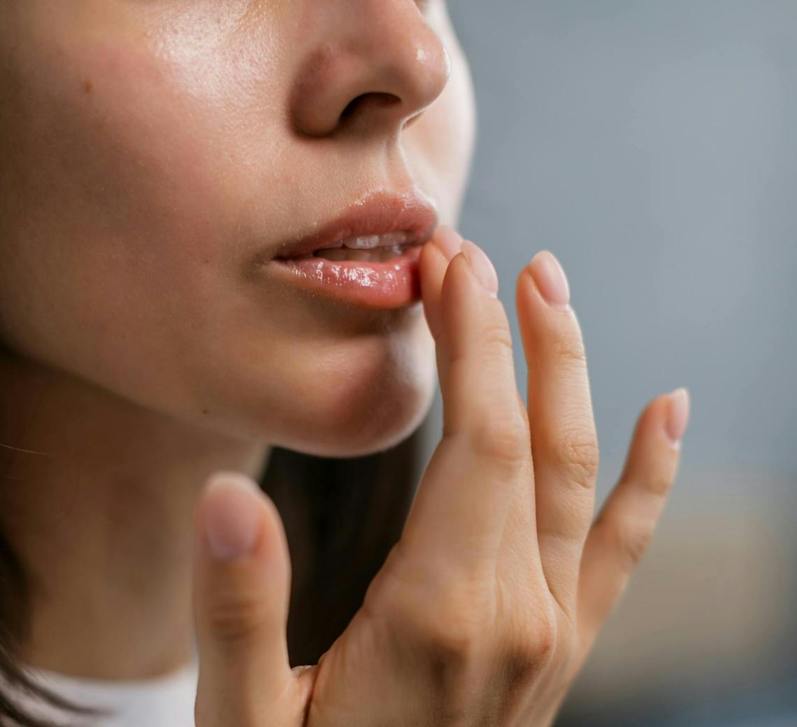 à éviter après injection acide hyaluronique lèvres