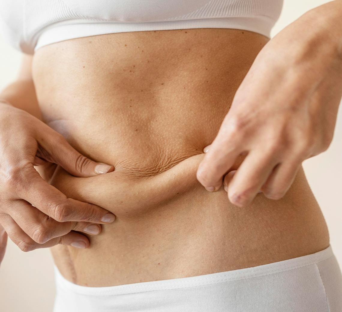 relâchement de la Peau du ventre