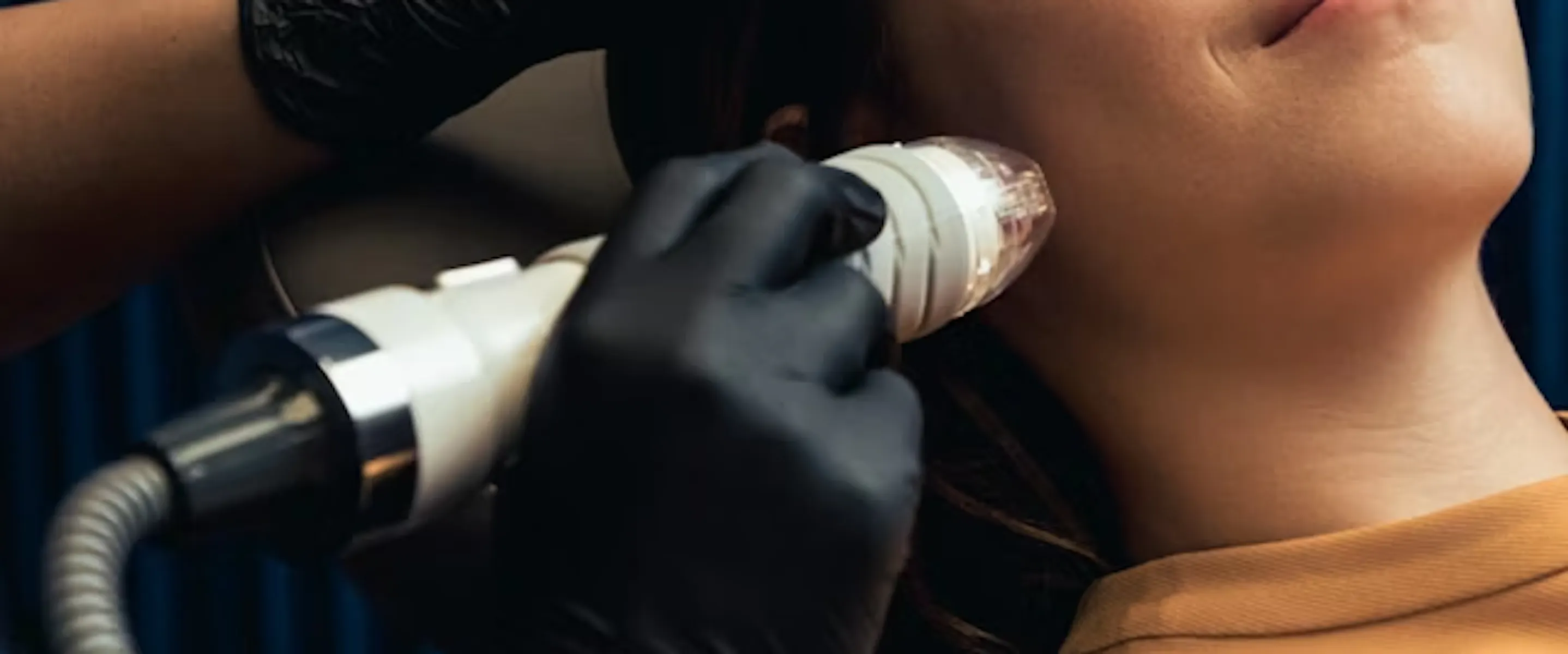 microneedling visage comment préparer sa peau | Maison Yokō