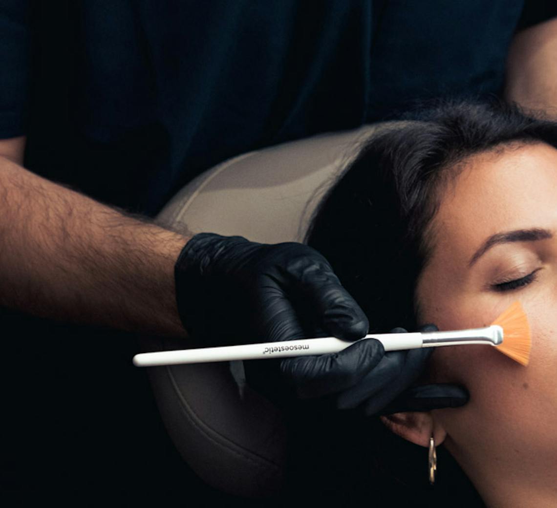 peeling pour taches brunes