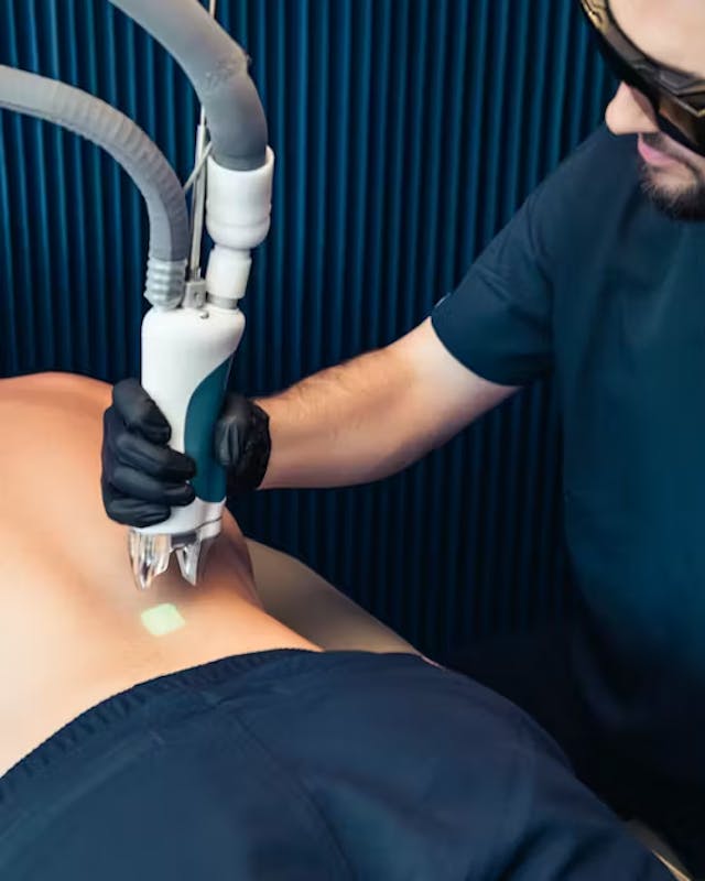 Séance d'épilation homme au laser, chez Maison Yoko