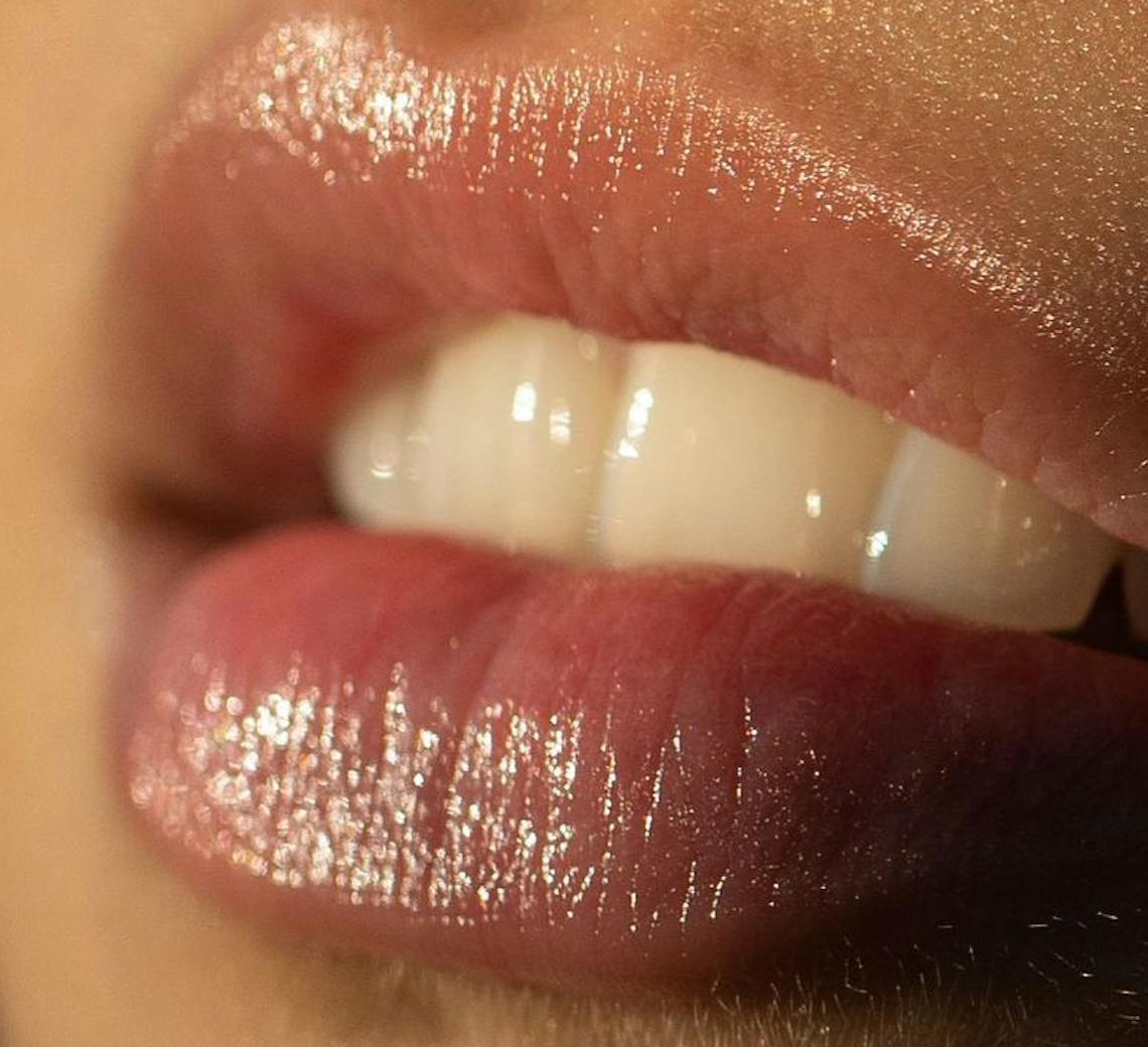 lèvres pulpeuses injections dans les lèvres