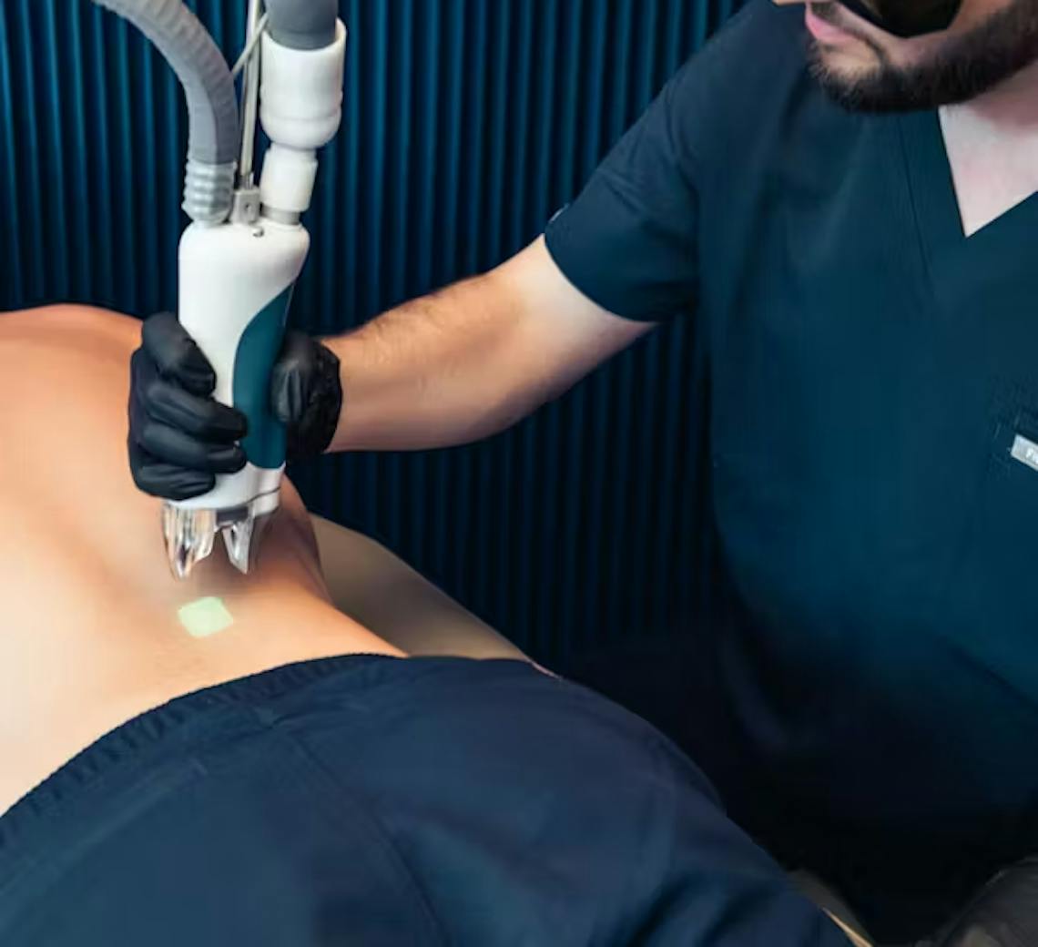 L'épilation laser pour les hommes : notamment pour les poils du dos, du torse, du nez etc.