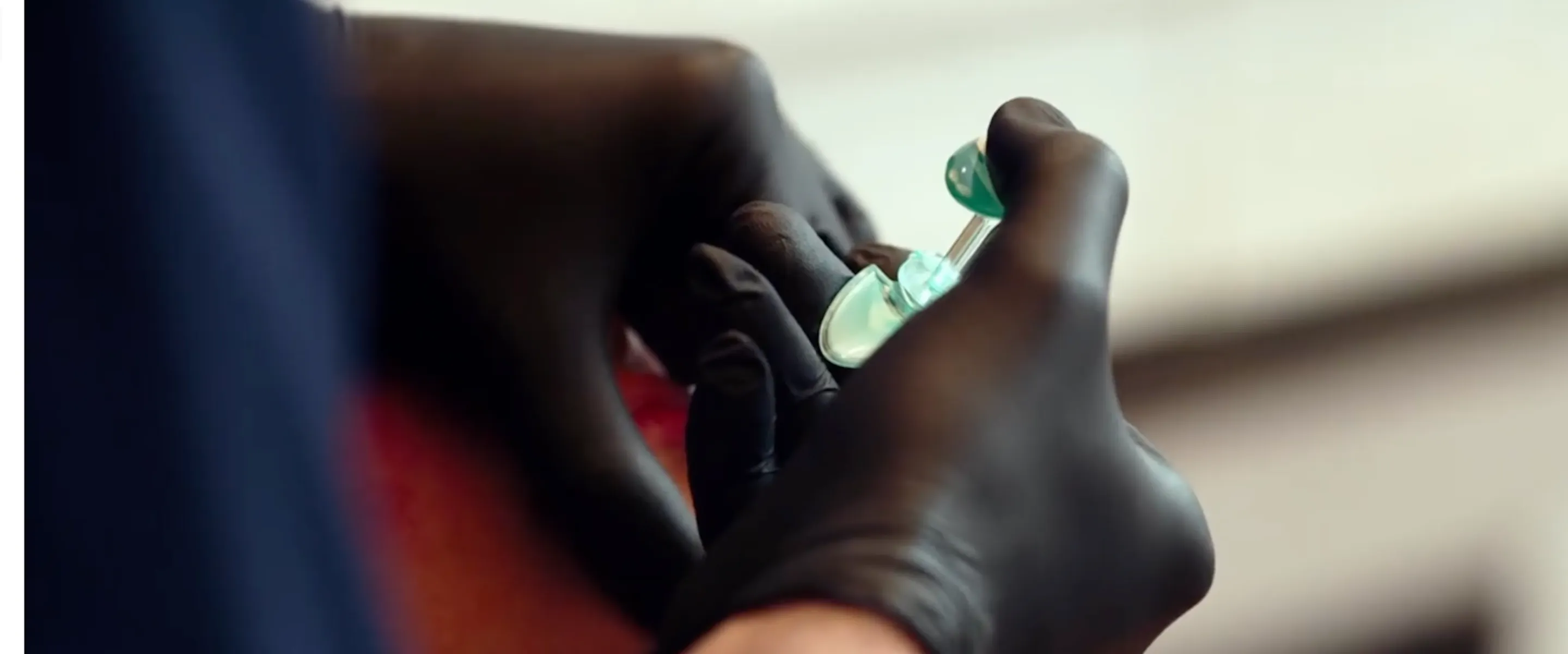 quand faire une retouche après injection d'acide hyaluronique chez Maison Yokō