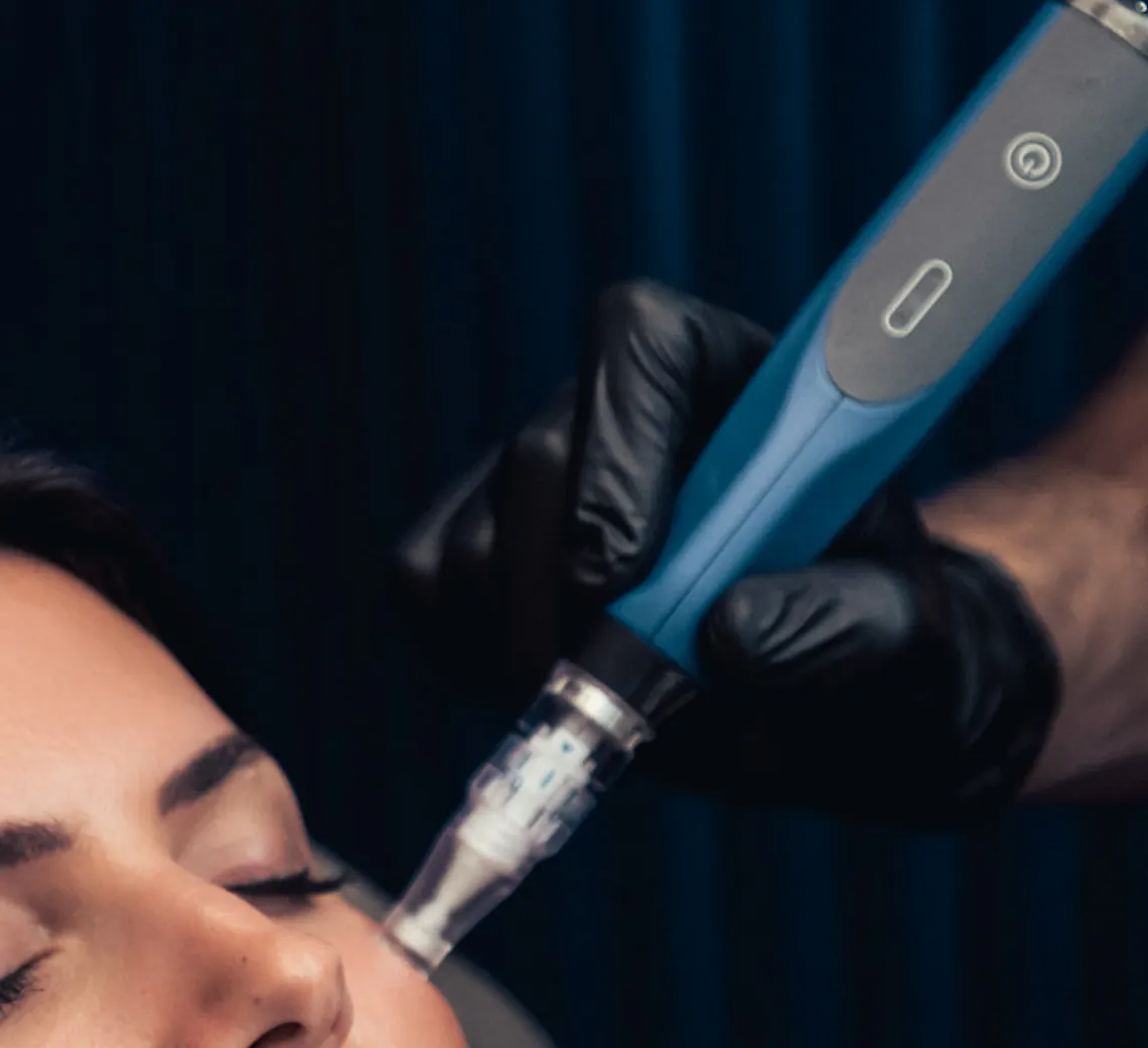 la barrière cutanée après un soin microneedling
