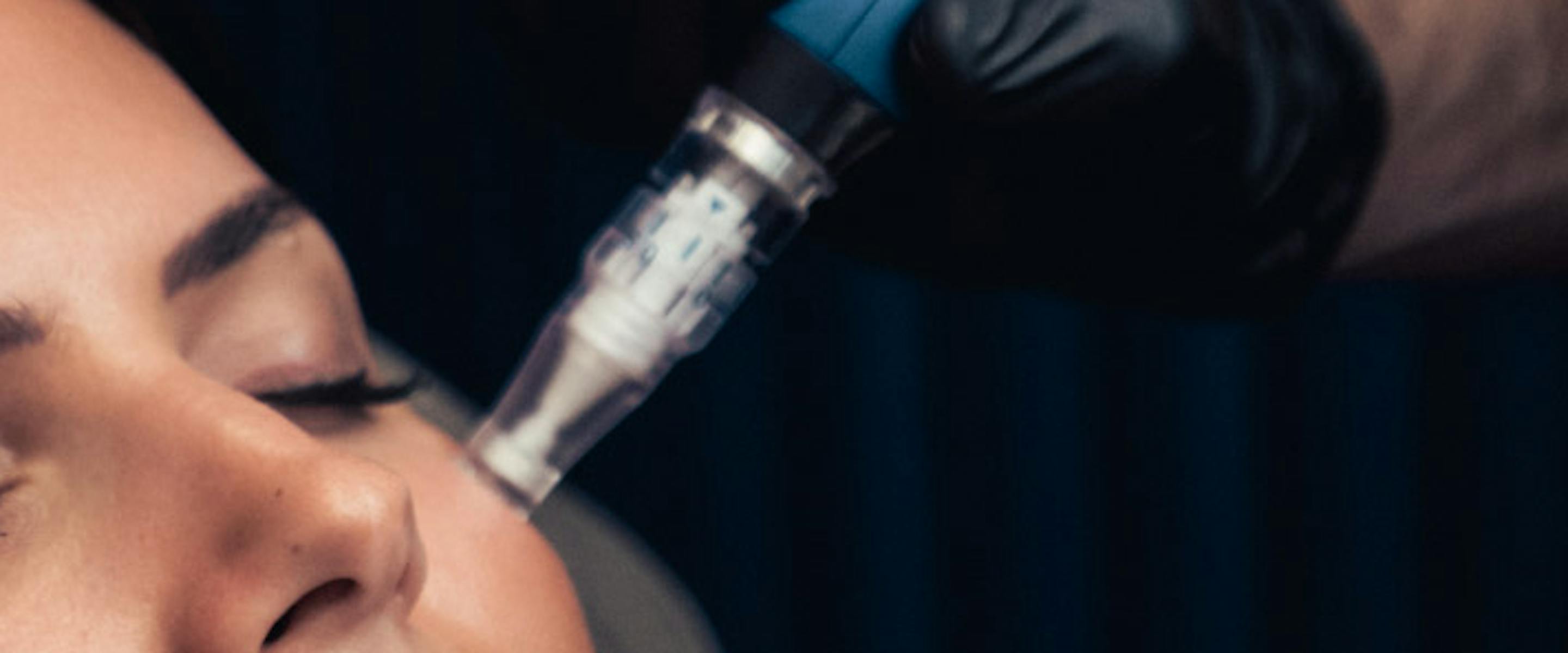 quel soin après un microneedling ? | Maison Yokō