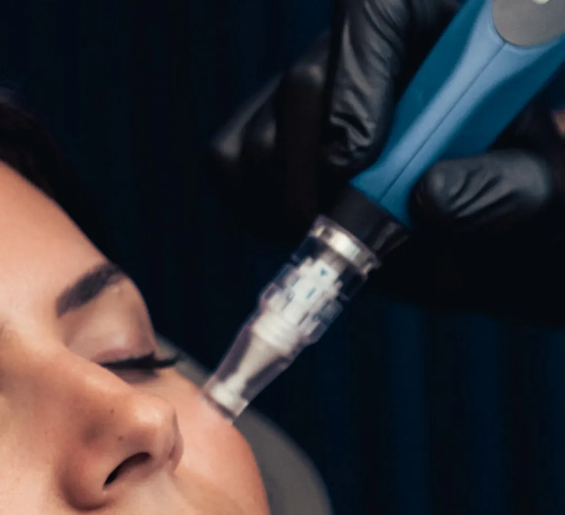 microneedling maison yoko