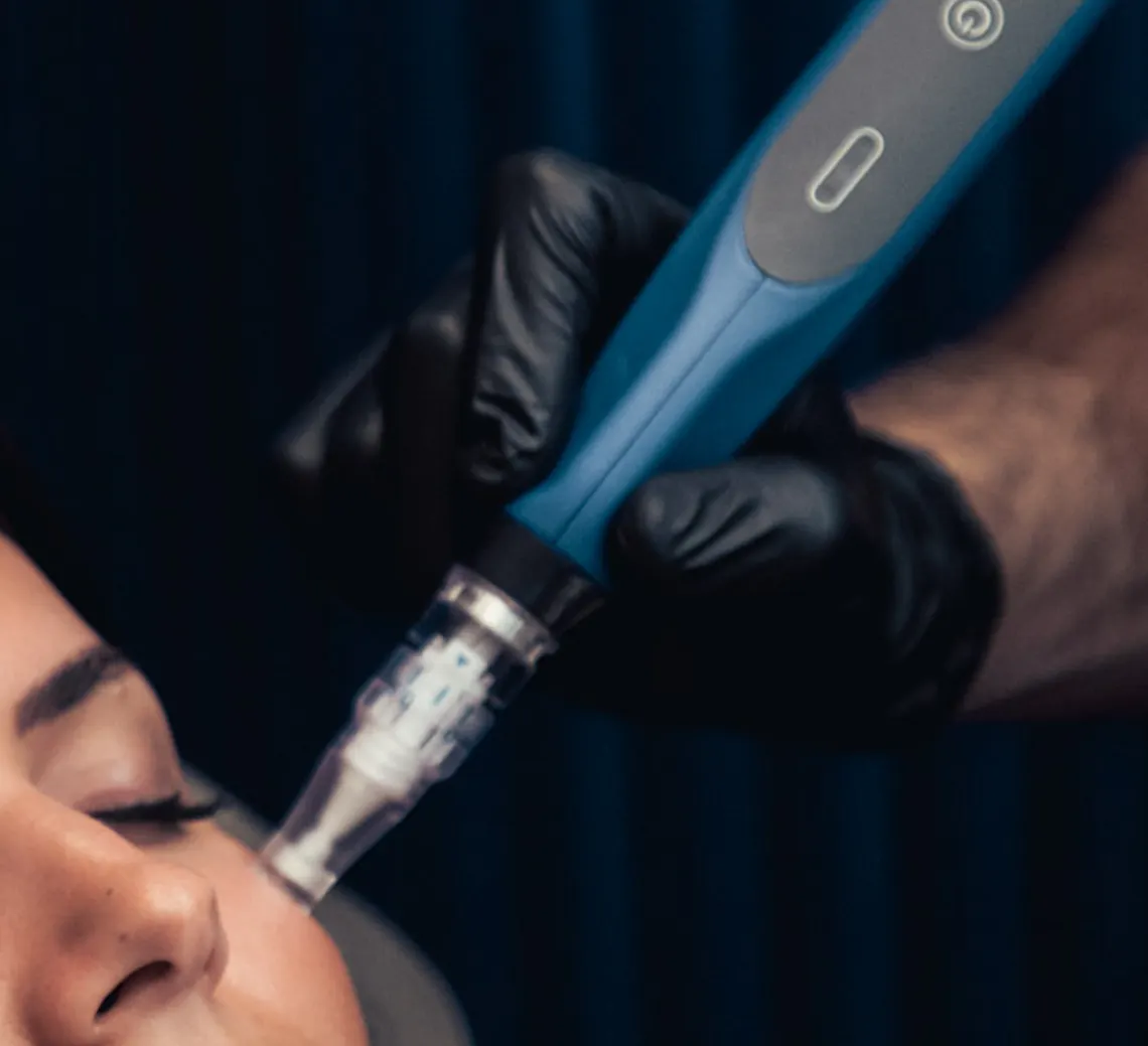 effet du microneedling sur la peau | Maison Yokō