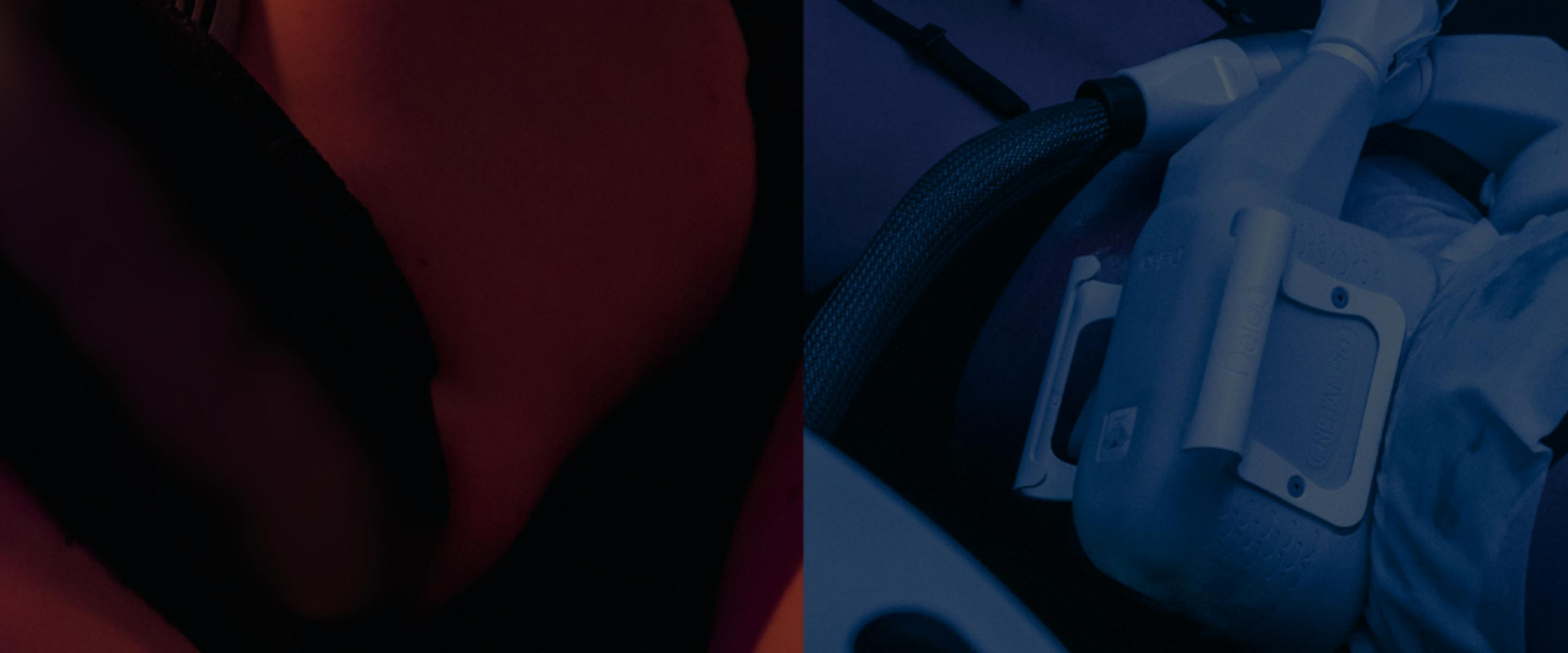 cryolipolyse VS emsculpt