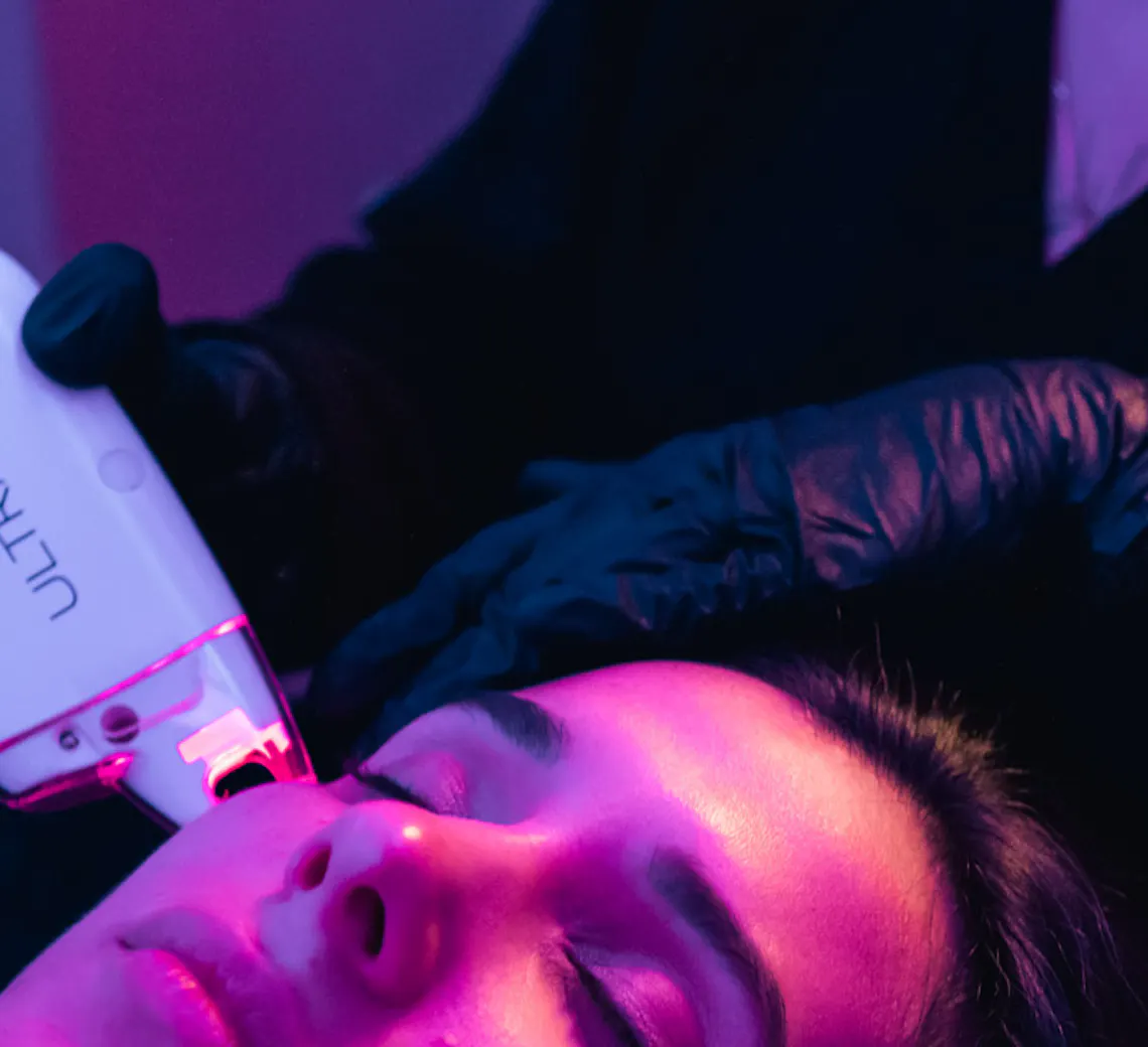 laser maison yoko guide