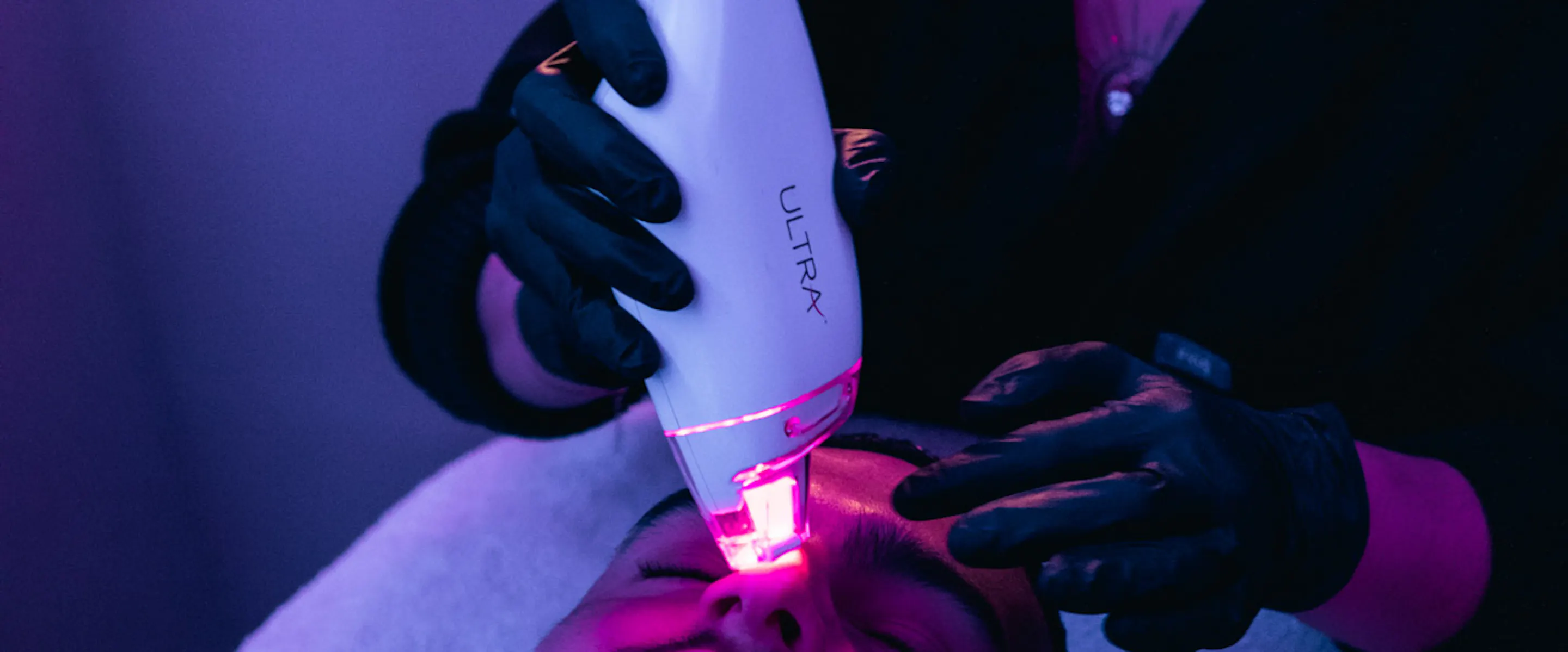 laser médecine esthétique