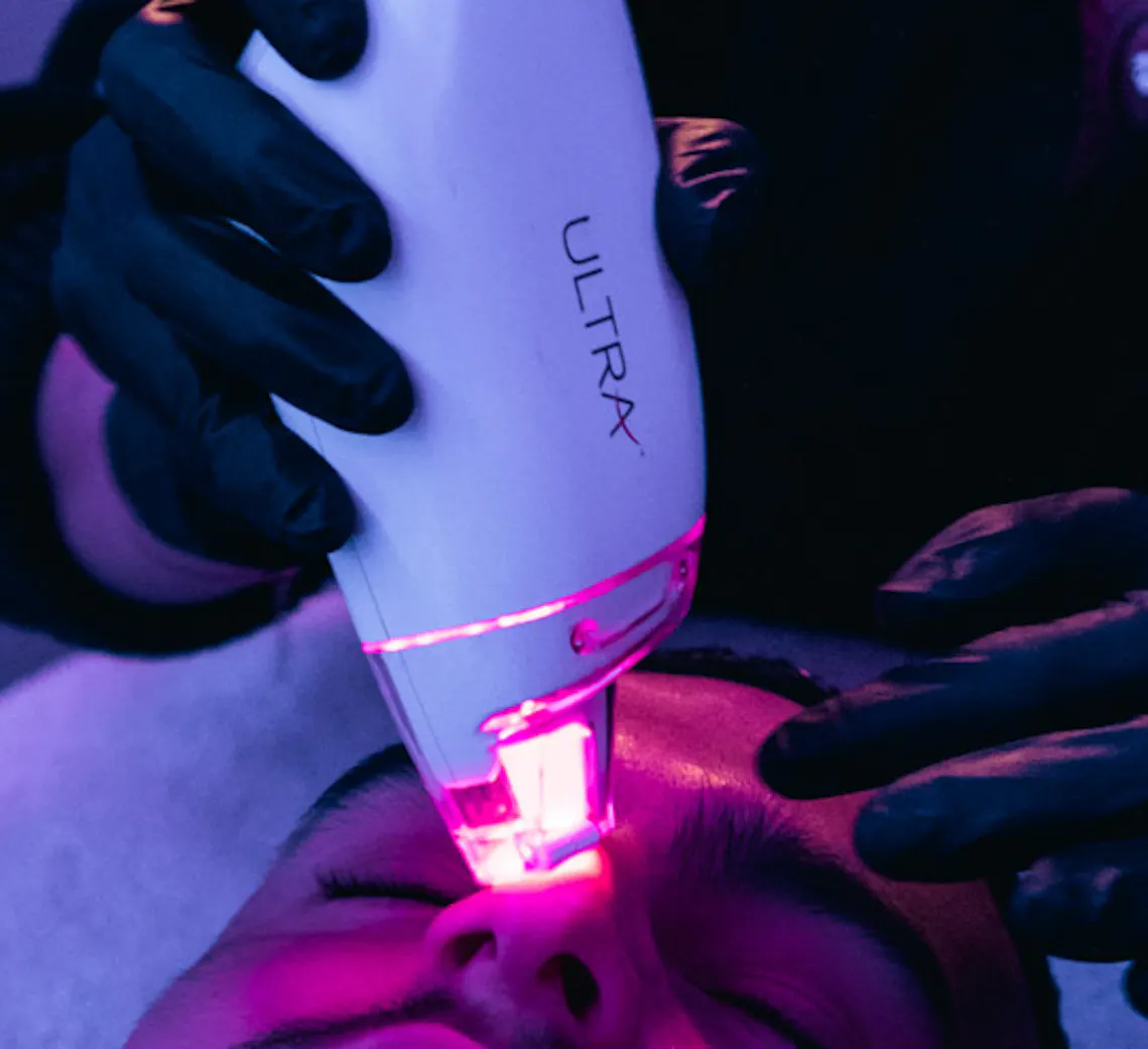 laser médecine esthétique