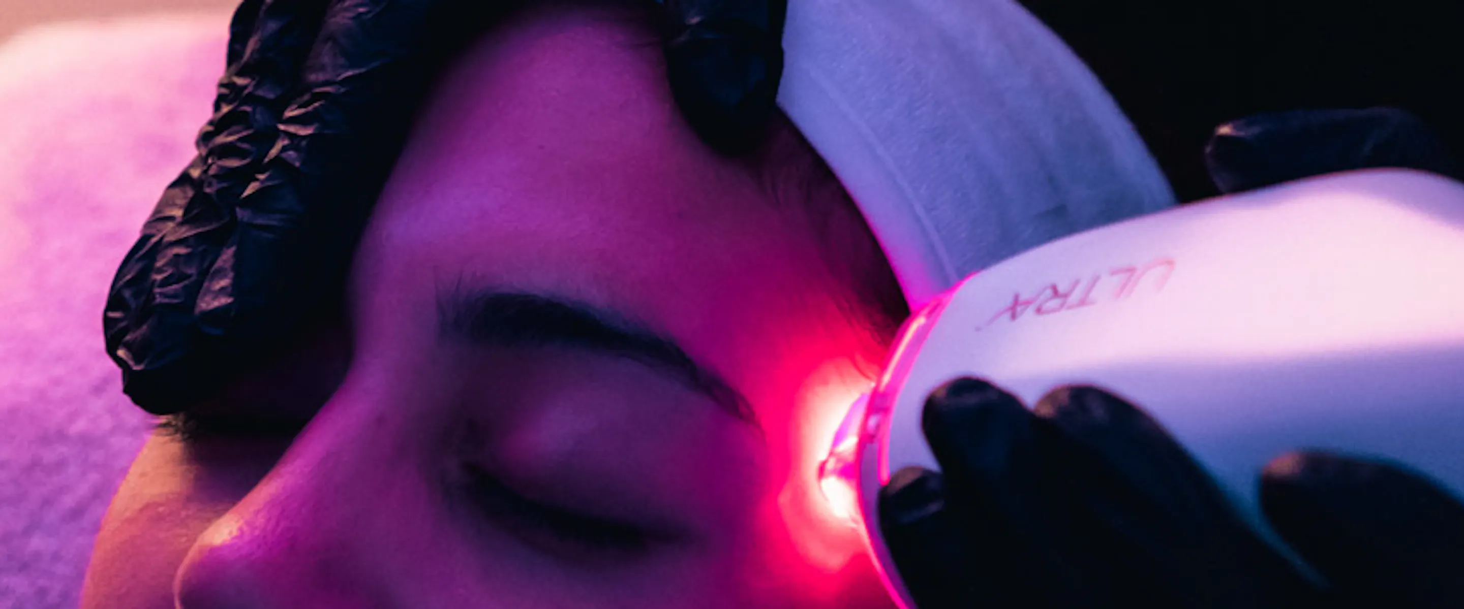 laser visage en été : les précautions à prendre | Maison Yokō