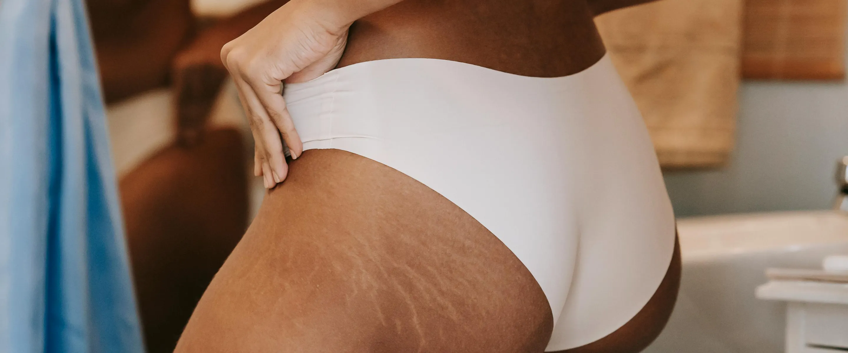 Les vergetures : qu’est-ce qui marche vraiment ?