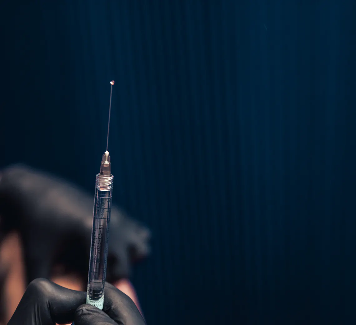 injection d'acide hyaluronique dans la jawline