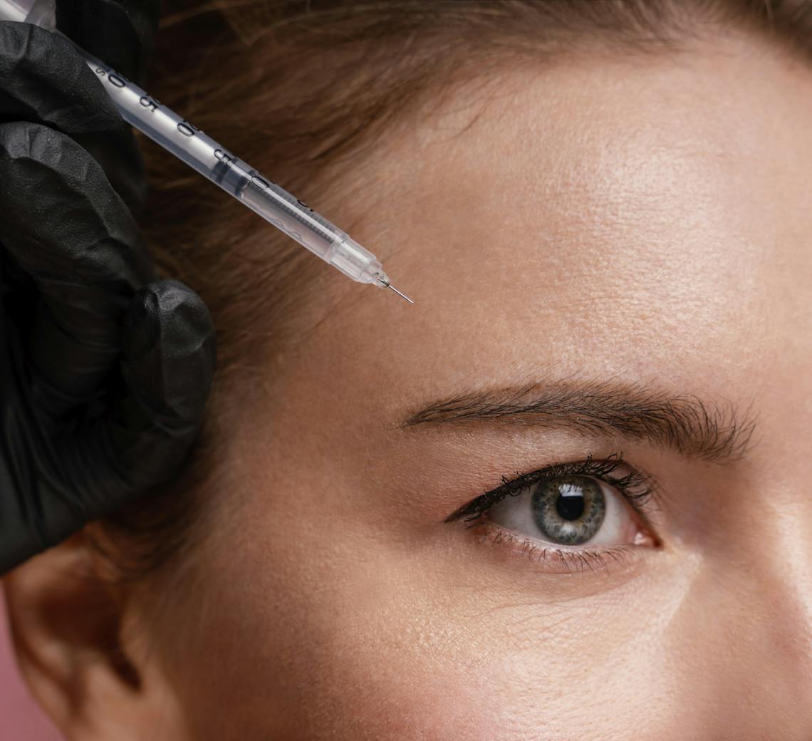 injection de botox pour un résultat naturel