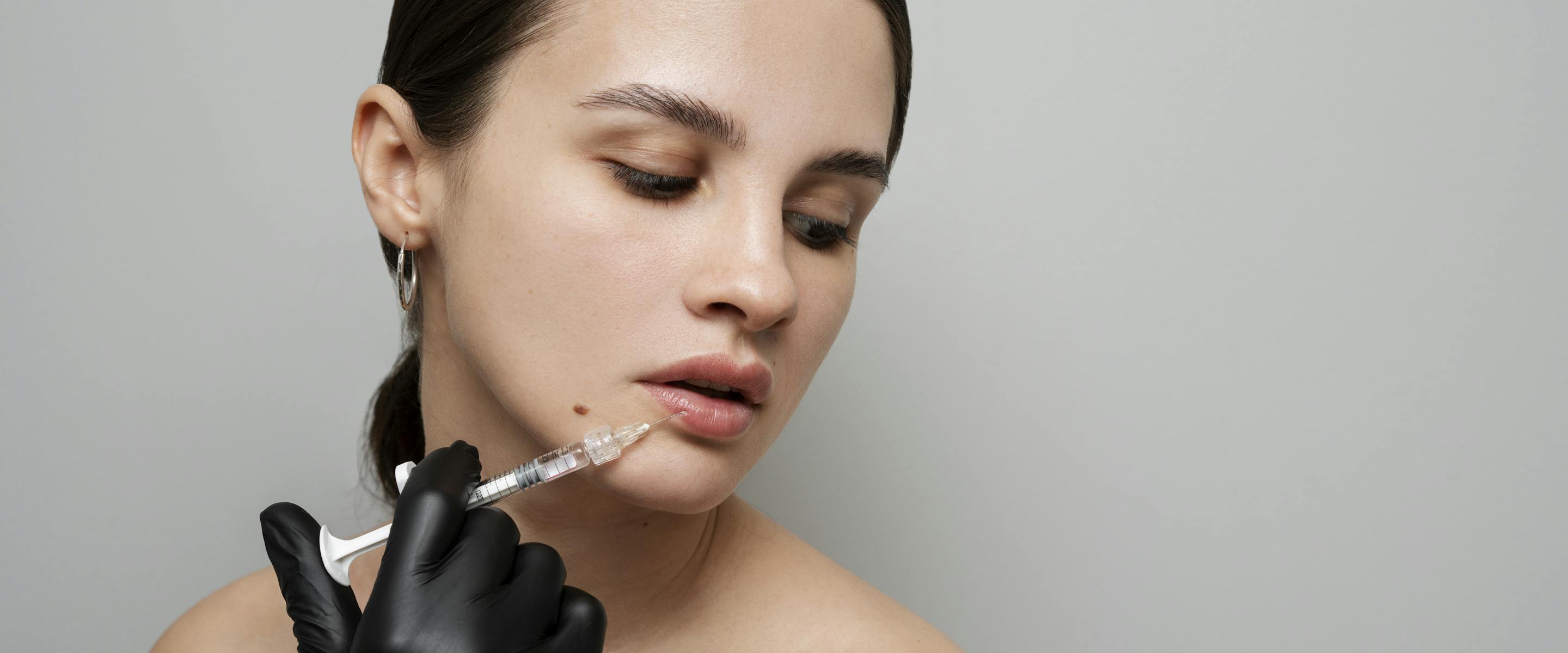 Injections d'acide hyaluronique : combien de temps ça dure ?
