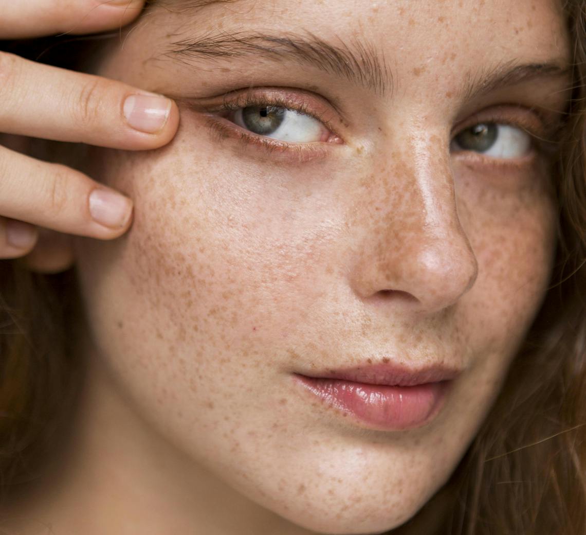 botox et soleil