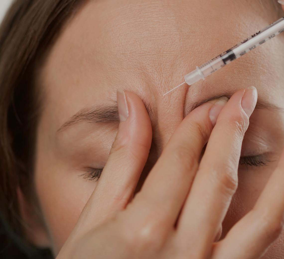 Comment le Botox agit-il sur la ride du lion ?
