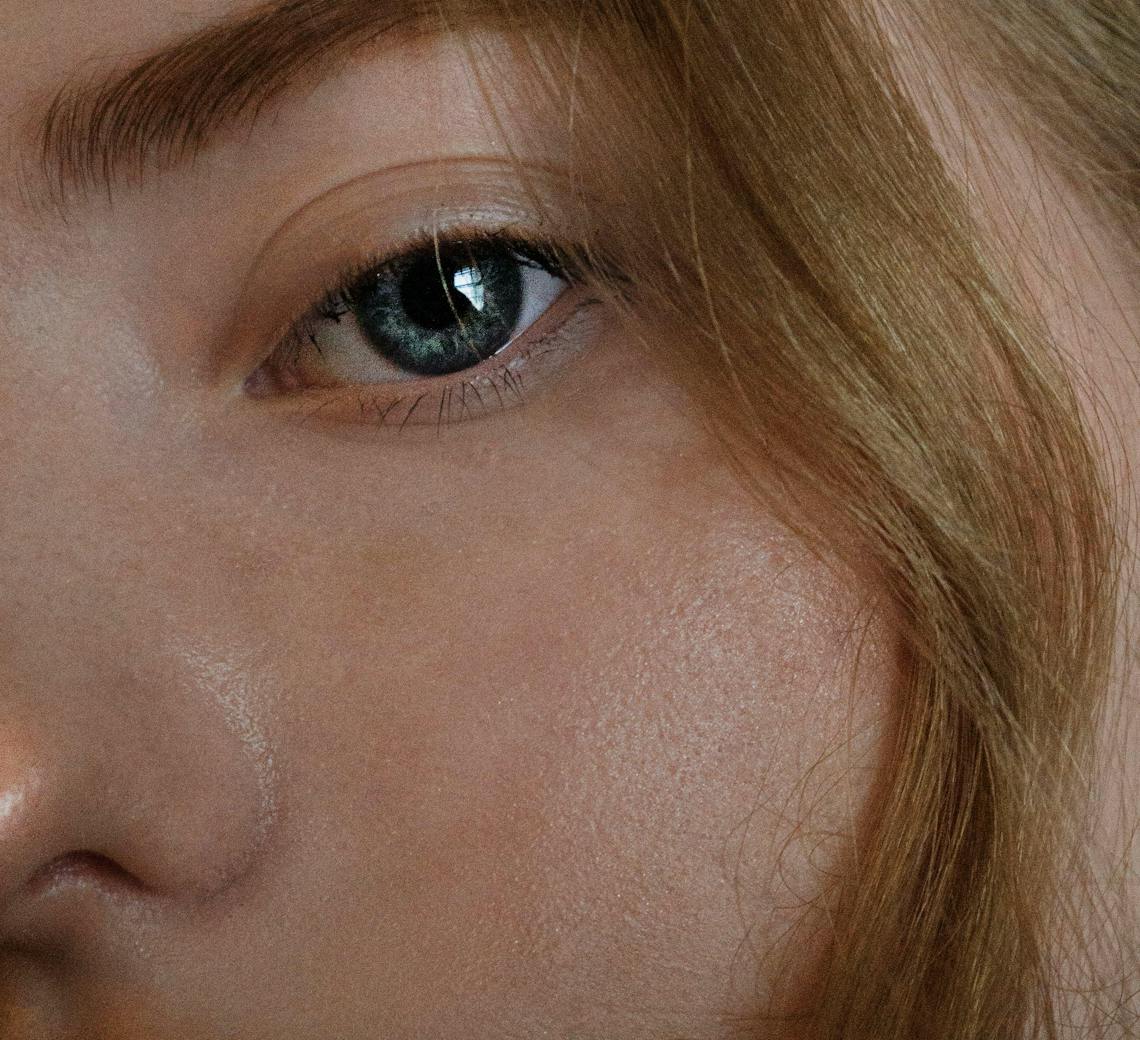 microneedling bienfaits