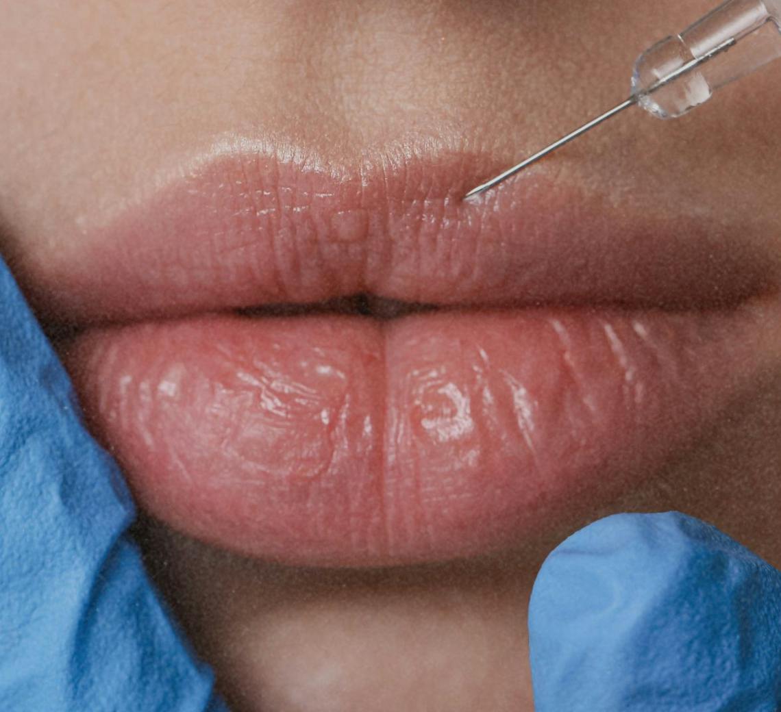 injections